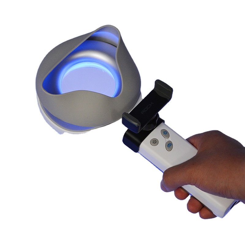 Cilt Bozukluğu Depigmentasyon  - Led Medical Headlight incelemesi ve fiyatı