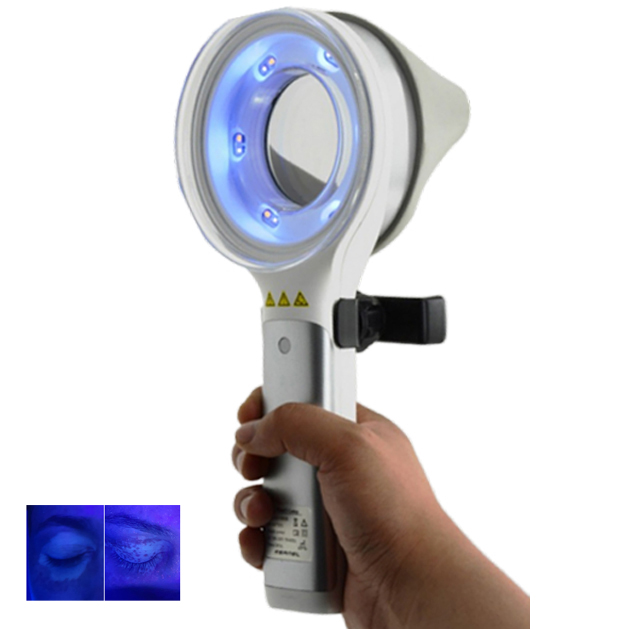 Cilt Bozukluğu Depigmentasyon  - Led Medical Headlight incelemesi ve fiyatı